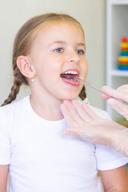 Speech therapy massage of the girl's tongue. a speech therapist makes a tongue massage to a child with a staging probe. Speech therapy massage of the girl's tongue. a speech therapist makes a tongue massage to a child with a staging probe.